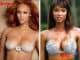 plastic surgery